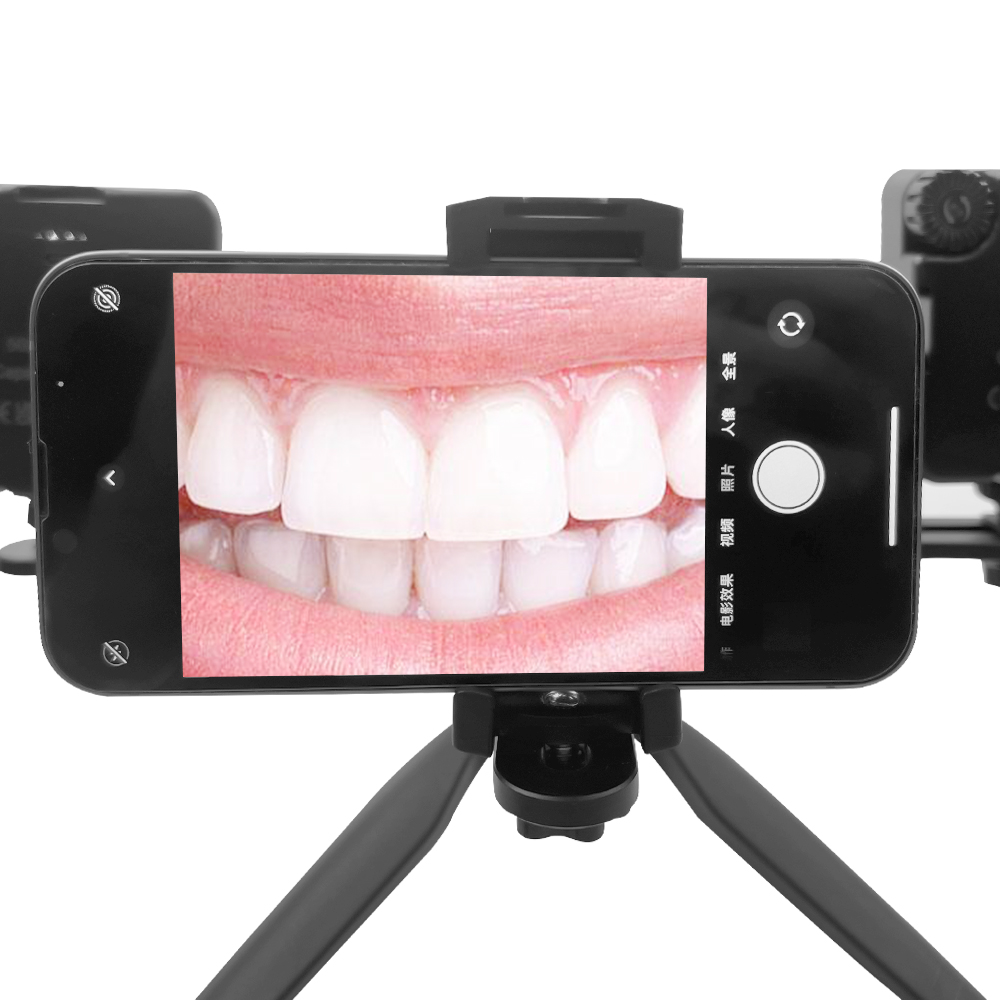 Стоматологическая фотография – обзор и цена Lighting Visual